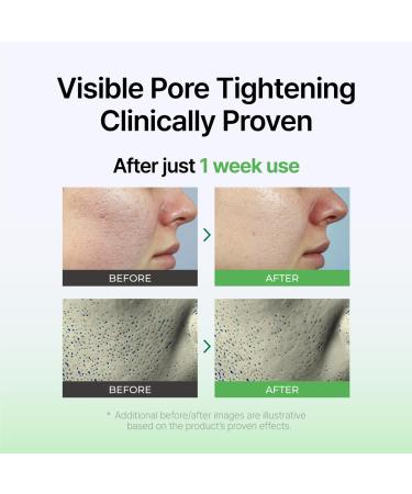 IZEZE Exosome PDRN Booster Ampoule 1.01 fl.oz 30 ml | Lifting and Firming Plant-Based PDRN Moisturizer for Dry Skin Korean Skincare Capsule Ampoule Centella Ampoule Serum - Buy Online on GoSupps.com