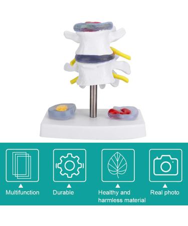 Anatomical Lumbar Intervertebral Disc Model - Spine Demonstration for Training & Education | International Shipping Available - Buy Online on GoSupps.com