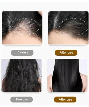 behound DrShangguan AntiHair Loss Shampoo Consciousney Antihair Loss and Hair Growth Shampoo Anti Hair Loss Shampoo for Women Men Ginger Shampo Fast Hair Growth for Thinning Hair 2 Pcs - Buy Online on GoSupps.com