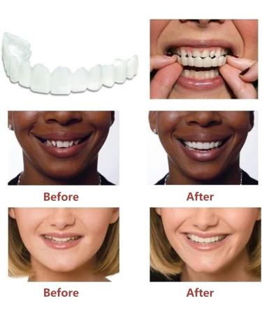 Fluktrix Instant Prosthesis Veins - Self-Confident Smile with Cosmetic Artificial Teeth & Provisional Braces for Men & Women | International Shipping Available - Buy Online on GoSupps.com