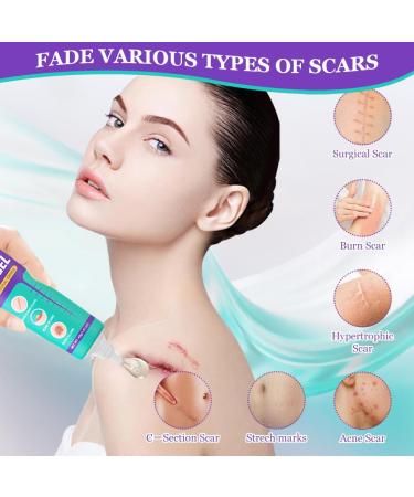  HASAIKA Scar gel cream for new and old scars smooth and hydrated skin 40 g - Buy Online on GoSupps.com