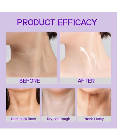 Retinol Neck Cream for The Appearance of Firming - Face Moisturizer with Hyaluronic Acid & Collagen - Helps Improve Look of Fine Lines & Skin Elasticity - 1.76 Fl Oz - Buy Online on GoSupps.com