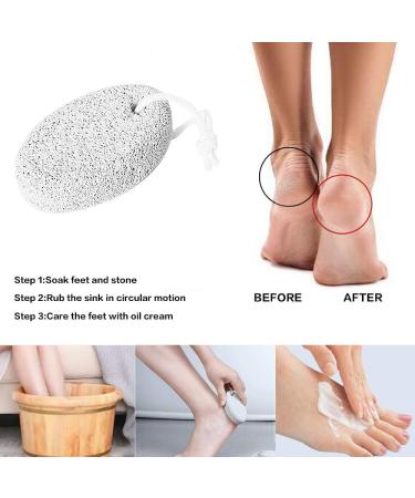 Pumice Stone 2Pcs Natural Lava Foot File for Callus Removal - Hand & Body Scrubber - Buy Online on GoSupps.com
