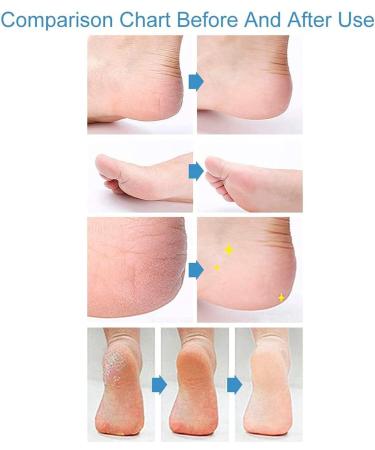 Westlab Soothing Dead Sea Salt 5kg Resealable Pouch - 100% Natural Mineral Salts for Nourishing & Soothing Dry Skin - Unscented - Pack of 1 - Buy Online on GoSupps.com