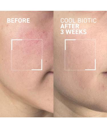 Dr. Brandt PB Cool Biotic Prebiotic Redness Relief Cream - 50g | Soothing Moisturizer for Sensitive Skin - International Shipping Available - Buy Online on GoSupps.com