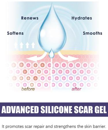 GAJUS 30 g scar gel for adults scar care gel to reduce surgical and old scars moisturizing scar cream for rapid regeneration and care - Buy Online on GoSupps.com