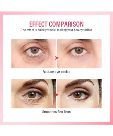 Eye Spray for Fine Lines & Dark Circles - Tighten Skin & Moisturize | International Shipping Available - Buy Online on GoSupps.com