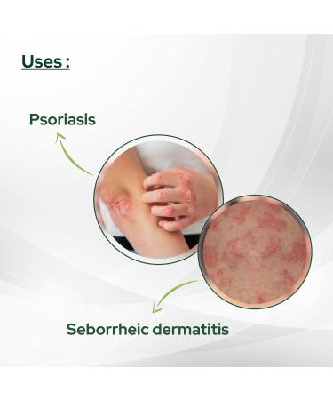 Salve Coal Tar Soap 75GM | Bergamot Tea Tree Jojoba Chamomile & Aloe Vera | Relieves Dry Itchy Skin | Pack of 6 - International Shipping Available - Buy Online on GoSupps.com