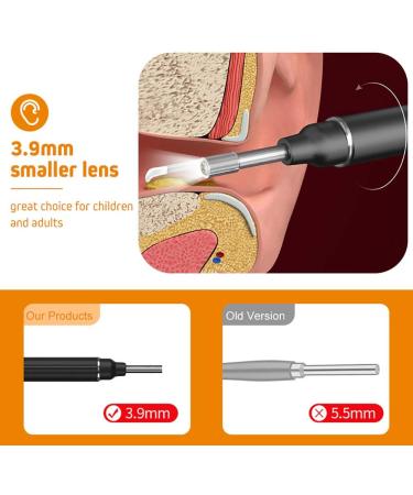 Wireless HD Ear Cleaner - 1080p Endoscope Otoscope with 6 LED Lights for Adults & Kids - Effective Ear Wax Removal - Buy Online on GoSupps.com