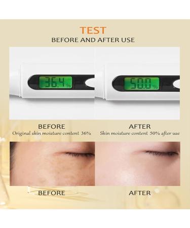 Turmeric Skin Brightening Serum Turmeric Face Serum Dark Spot Remover Serum For Face Skin Lightening Serum Turmeric Facial Serum for Lifting & Age Spots Sun Spot Improve Skin Tone - Buy Online on GoSupps.com