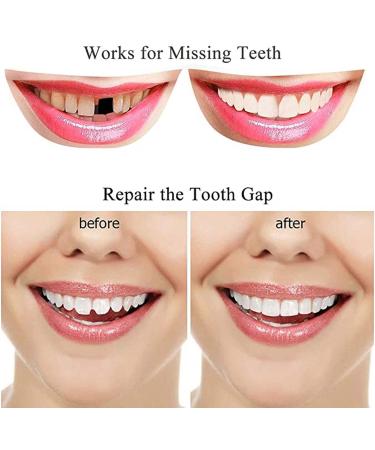 FXiaoy Regain Confidence Smile for Women and Men Temporarily Adjustable 2 Pairs - Buy Online on GoSupps.com