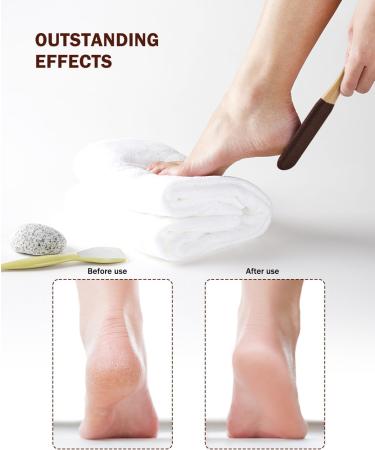 Foot Scrubber for Dead Skin with Bamboo Handle Brown - Buy Online on GoSupps.com