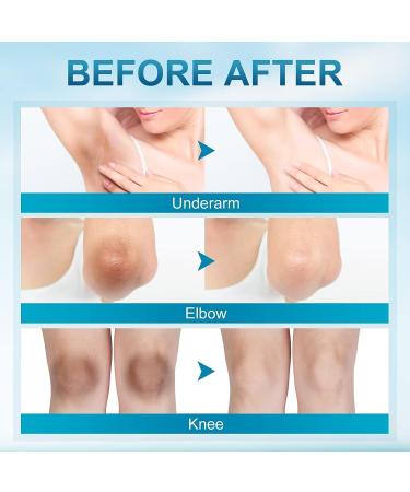 Dark Spot Remover Cream for Face & Body - Brightening & Moisturizing Underarm Cream for Private Areas - Buy Online on GoSupps.com