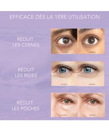 Self-Dissolving Micro-Needle Eye Patches | Reduces Dark Circles Wrinkles & Puffiness | Tones Eye Area | Caffeine Hyaluronic Acid Collagen & More.. | (2) - Buy Online on GoSupps.com