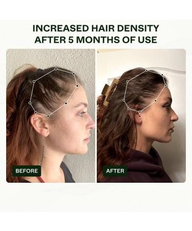 Scandinavian Biolabs Hair Growth Serum for Women 3 Pack | Natural Hair Loss Treatment for Women Without Minoxidil | Hair Regrowth Treatment for Women - Buy Online on GoSupps.com