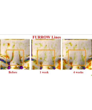 WhiteSilk Expert Drops SCM 30 + Retinaldehyde 0.1 Complex Ampoule for Wrinkles, Acne, Damage & Hydration - 0.68oz - Buy Online on GoSupps.com