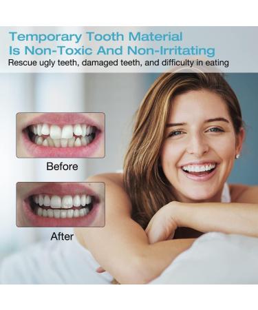 Affordable Instant Dentures & Tooth Veneers for a Bright Smile - Comfortable Fit with Tweezers for Men & Women - Buy Online on GoSupps.com