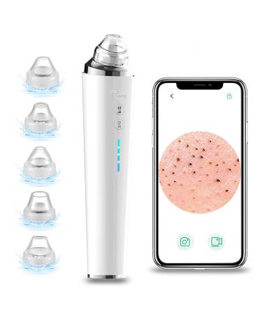 PSKMKS Blackhead Remover Vacuum with Camera 2021 Upgraded 5.0 MP Visual Facial Pore Cleaner USB Rechargeable Acne Comedone Whitehead Extractor Sucker Tool Blackhead Remover Kit Suction for Women & Men Milk White