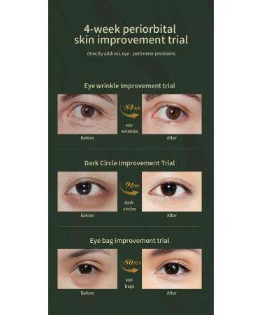 SK I SGEM Age Rejuvenating Eye Cream for Eye Bags Dark Circles and Puffiness Reduce Eye Lines Anti Aging Fine Lines Firming Delicate Skin Under Eyes 30G - Buy Online on GoSupps.com