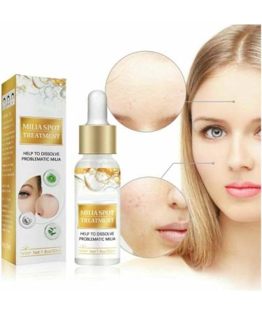 ZHBiwmatn 2024 New 4Pcs Milia Clearing Essence Milia Remover Eye Serum Milia Remover Milia Spot Treatment Miliary Repair Essence Moisturize Skin Improve Skin Texture for All Skin Types 30ml/1.8fl.oz - Buy Online on GoSupps.com