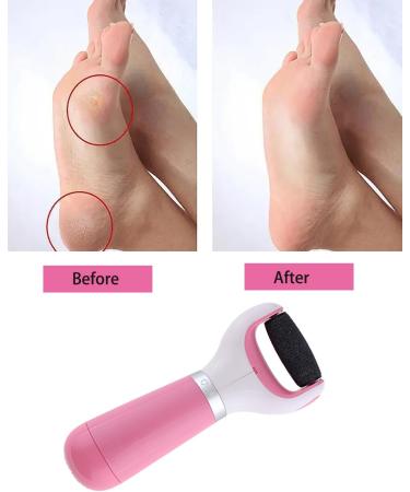 Electric Callus Remover for Feet - USB & Battery Powered Foot Buffer Tool with Pink Roller for Smooth Pedicures - International Shipping Available - Buy Online on GoSupps.com