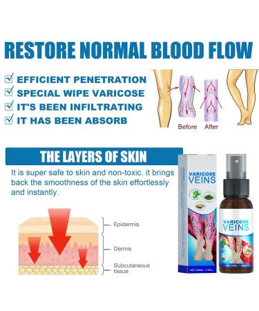 3 Piece Varicose Vein Treatment Spray Set | Soothing Vein Healing Spray for Legs | Effective Relief for Varicose Veins - Buy Online on GoSupps.com