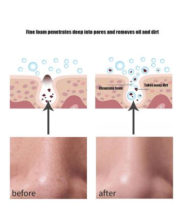 Cleansing Milk with Niacinamide - Hydrating Facial Cleanser for Women | Xuerouyar Purifying Face Wash - 1PC - International Shipping Available - Buy Online on GoSupps.com