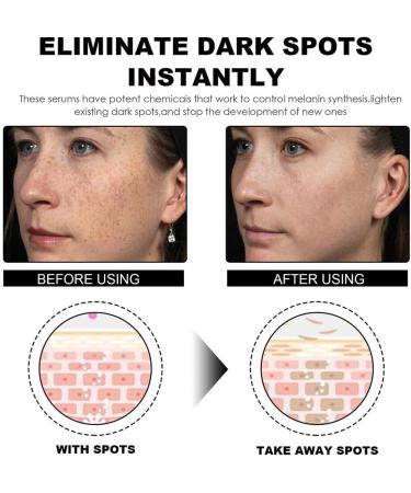 Dajidafu Women Face Anti-blackspot Ladies Whitening Moisturizing Blackspot Removal Essence Blemish Remover Beauty Supplies - Buy Online on GoSupps.com
