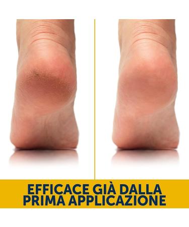  Podovis PODOVIS Foot Cream to Reduce & Prevent Calluses 60 ML - Buy Online on GoSupps.com