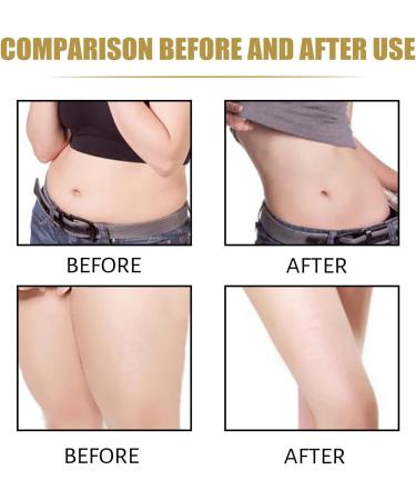 70 ml Ginger Slimming Oil - Natural Weight Loss Essential Oil for Body Shaping & Metabolism Boost - Buy Online on GoSupps.com