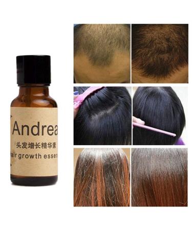 Andrea Hair Growth Essence - Stop Hair Loss & Enhance Hair Condition 20ml - Buy Online on GoSupps.com