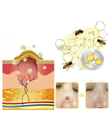 Bee Venom Skin Treatment Cream Skin Removal and Skin Care for Face and Body for All Skin Type Fast and Effective (1Can) - Buy Online on GoSupps.com