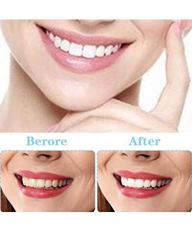 Jiazhouhb 2 Pairs Temporary Fake Teeth - Dental Veneers Artificial Dentures White Cosmetic Prostheses for International Shipping - Buy Online on GoSupps.com