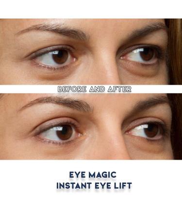 Premium Eye Lift Strips S/M Size 80 Count Pack for Droopy Sagging or Hooded Eyelids Instant Non-Surgical Eyelid Tape Hypoallergenic Transparent Strong Hold Made in USA 80 Count (Pack of 1) - Buy Online on GoSupps.com