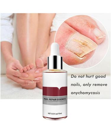 1PC Nail Treatment Nail Renewal Solution Toenails & Fingernails Nail Repairs Essential Oil Protects From Discoloration Brittle And Cracked Nail(12ML)  - Buy Online on GoSupps.com