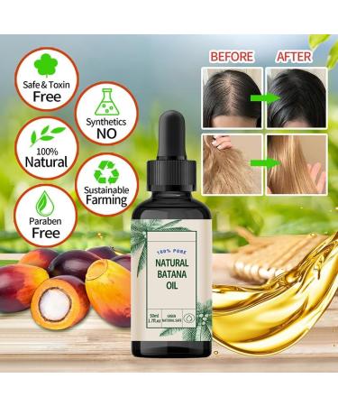 YSZZYSM Batana Oil for Hair Growth 100% Natural and Pure to Prevent Hair Loss and Eliminate Split Ends for Men and Women - Buy Online on GoSupps.com