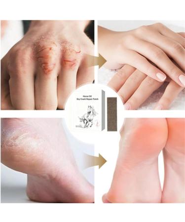 Horse Oil Dry Crack Repair Patch foot cream for dry cracked heels and feet Horse Oil foot balm repairing cream for knees elbows and hands Hands - Buy Online on GoSupps.com