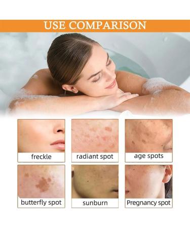 Turmeric Soap Bar Kojic Acid Soap Turmeric Soap Bar Turmeric Brightening Soap Turmeric Soap Bar for Face & Body Natural Turmeric Skin Soap Remove Acne Blackheads Dark Spot for Deep Cleansing - Buy Online on GoSupps.com