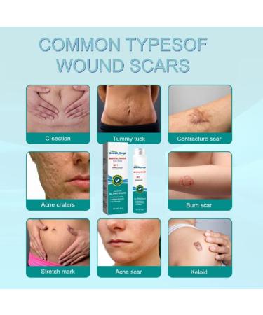 Advanced Scar Removal Spray - Medical Grade Treatment for Acne Scars and Dark Spots - Gentle Skin Care (5PCS) - Buy Online on GoSupps.com