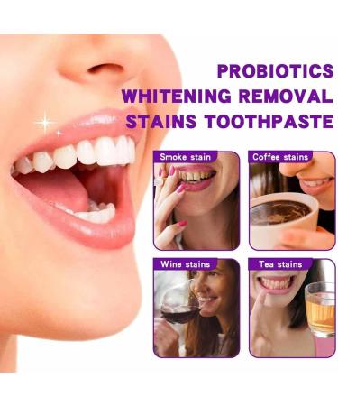 Buy SP-7 Probiotic Whitening Toothpaste - Ultra Brightening & Stain-Removing Formula (1 Piece) - International Shipping Available - Buy Online on GoSupps.com