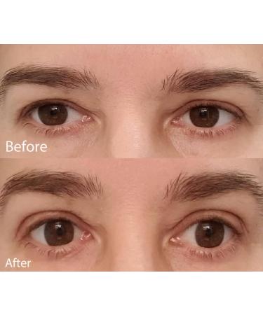 948Count Natural Invisible Single Side Eyelid Tape Stickers Medical-use Fiber Eyelid Correction Strip Instant Eye Lift Without Surgery Perfect for Droopy Hooded Uneven Mono-Eyelids HZ 948Count - Buy Online on GoSupps.com