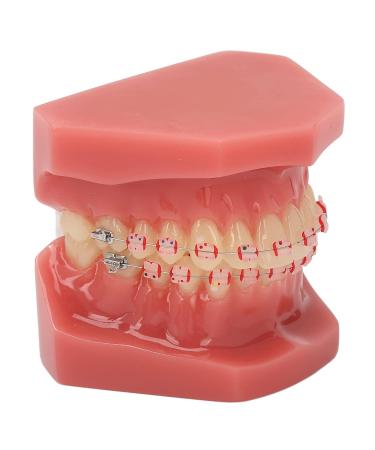Orthodontic Demonstration Model for Dental Research | Metal Wires & Ceramic Brackets | Teaching Aids for Adults - Buy Internationally - Buy Online on GoSupps.com