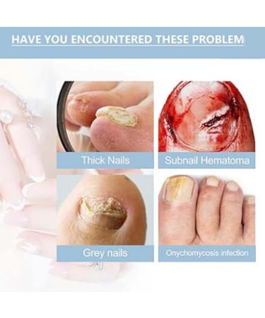 OnyxoGuard Nail Growth and Repair Serum Serum Nail Strengthener Nail Strengthening and Growth for Thin Nail Brittle & Damaged Strengthener Base Coat Nail Polish Repair Nail Growth Treatment (3Pcs) - Buy Online on GoSupps.com