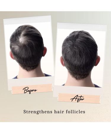 Organic Hair Growth Serum 1 oz | Scalp-Stimulating Hair Oil for Thinning & Hair Loss | Suitable for All Hair Types - Unisex Formula - Buy Online on GoSupps.com
