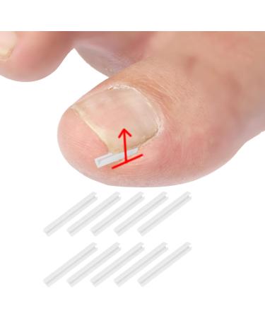 BEALIFE Curved Toenail Corrector Strips for Ingrown Toenails Effective Foot Care Solution - Buy Online on GoSupps.com