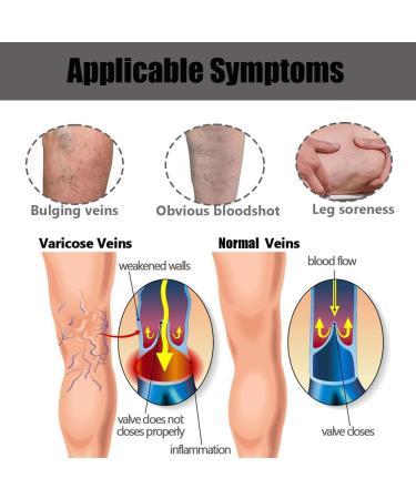 Varicose Veins Relief Patches - Soothe Leg Discomfort & Boost Circulation - 48 PCS | International Shipping Available - Buy Online on GoSupps.com