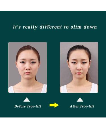Buy Facial Slimming Mask & Lifting Strap - V Face Chin Lift for Women | Eliminate Limp Skin - Buy Online on GoSupps.com