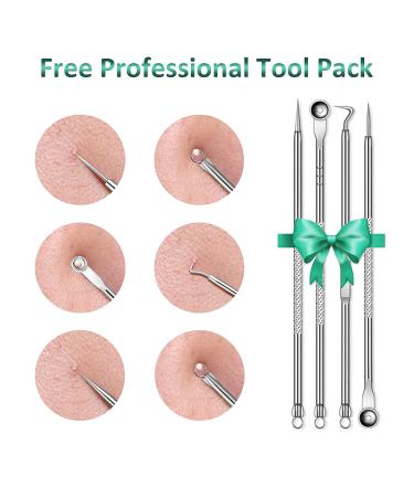 Blackhead Remover Pore Vacuum with Camera - Rechargeable Blackhead Suction Tool for Face and Nose - Skin Acne Pimple Cleaner for Men and Women - Buy Online on GoSupps.com