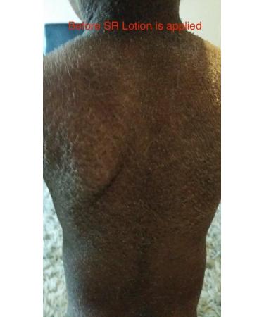 G16 Skin Repair Lotion: Effective Ichthyosis Treatment Cream for Outstanding Results in 2 Weeks - Buy Online on GoSupps.com