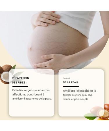  G n rique Stretch Mark Cream for Pregnancy | 50g Pregnancy Belly Care | Non-Greasy Texture Prevents Stretch Marks and Improves Skin Elasticity | Moisturizing and Preventative - Buy Online on GoSupps.com